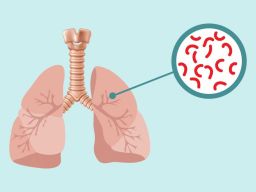 Pemerintah Pusat Tetapkan Estimasi Penemuan Kasus TBC Tahun 2023 Sebanyak 11.863 Kasus  