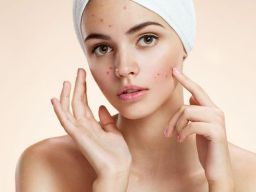 Simak! Berikut Langkah Dini Cegah Jerawat Kulit Wajah Hingga Cerah Bersinar