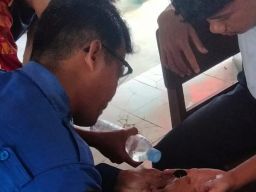 Siswa SMP di Pemalang Panik Cincin di Jarinya Tak Bisa Dilepaskan, Tim Damkar Segera Bertindak