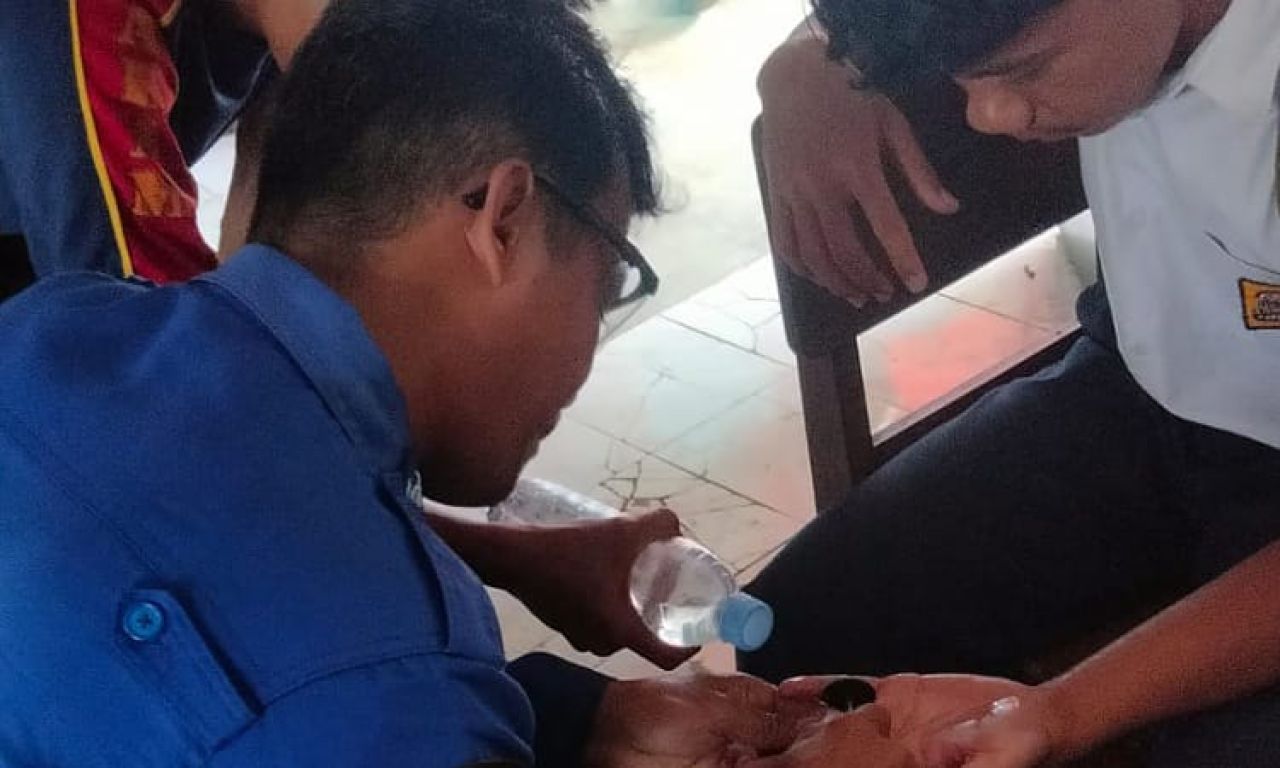 Siswa SMP di Pemalang Panik Cincin di Jarinya Tak Bisa Dilepaskan, Tim Damkar Segera Bertindak